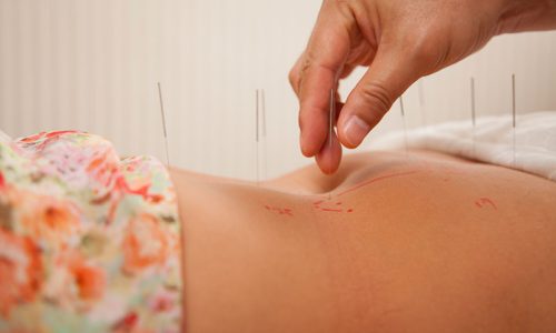 Acupuncture Herbal Center Fertility Treatments